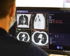 Tomógrafo en un hospital del NHS