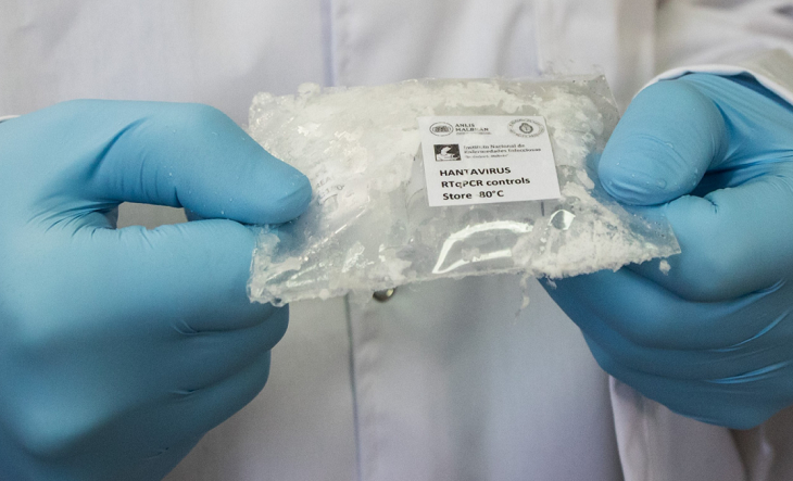 Laboratorio del Malbrán con equipos de diagnóstico